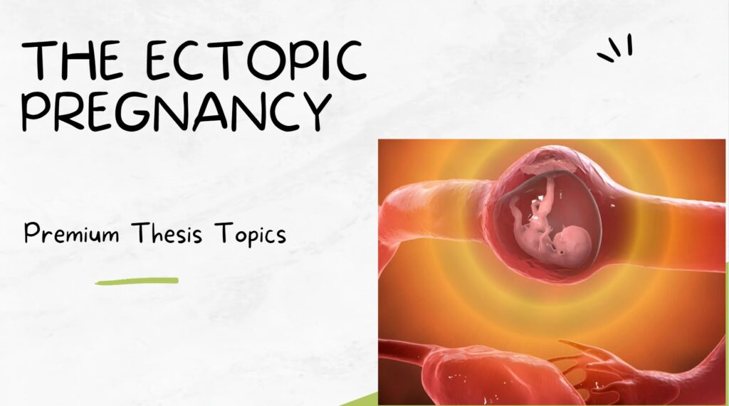 Ectopic Pregnancy Thesis Topics