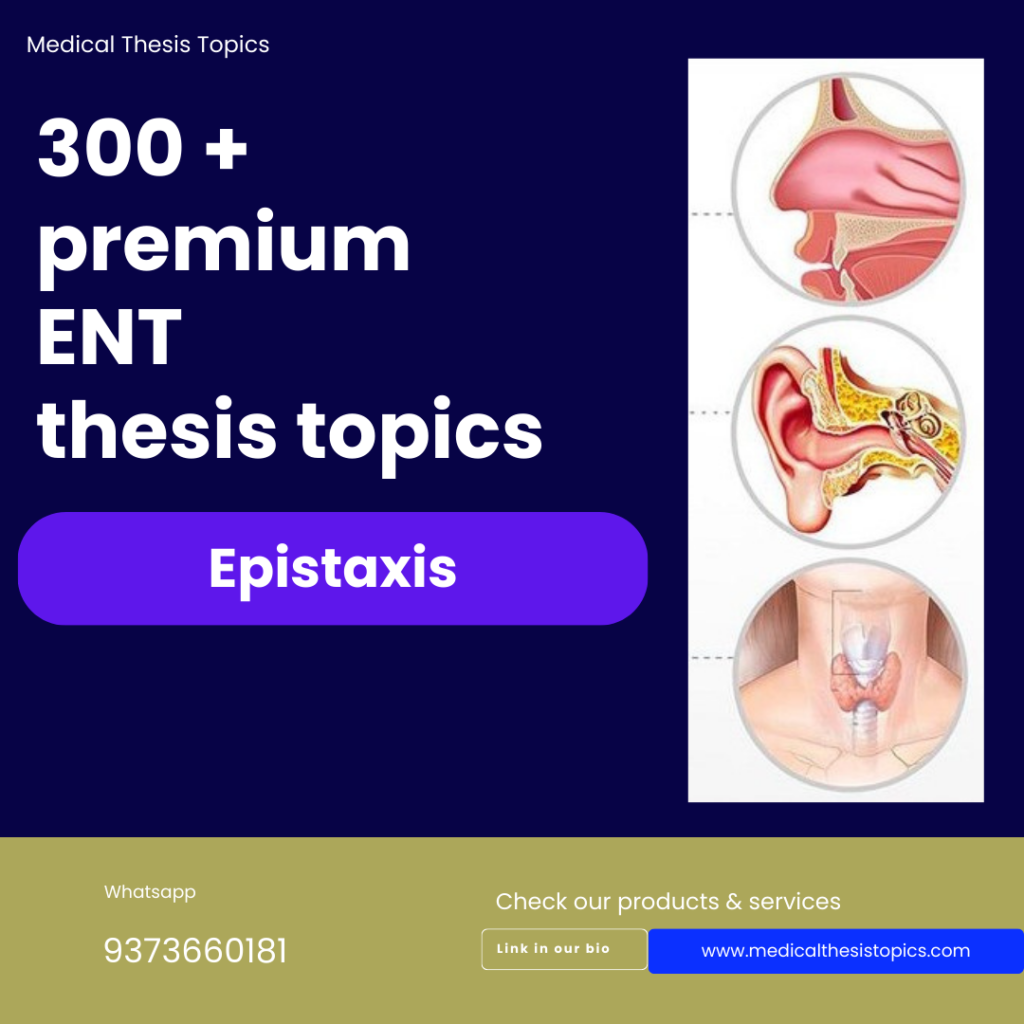 Epistaxis thesis topics